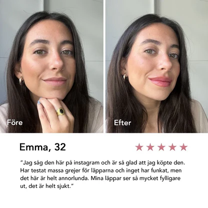 BloomLips - Naturlig volym utan nålar